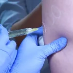 Selulit Memang Susah Hilang, tapi Meso Cellulift Bisa Menyamarkannya