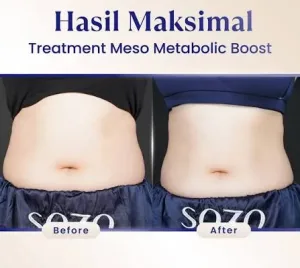 Hasil Meso Metabolic Boost