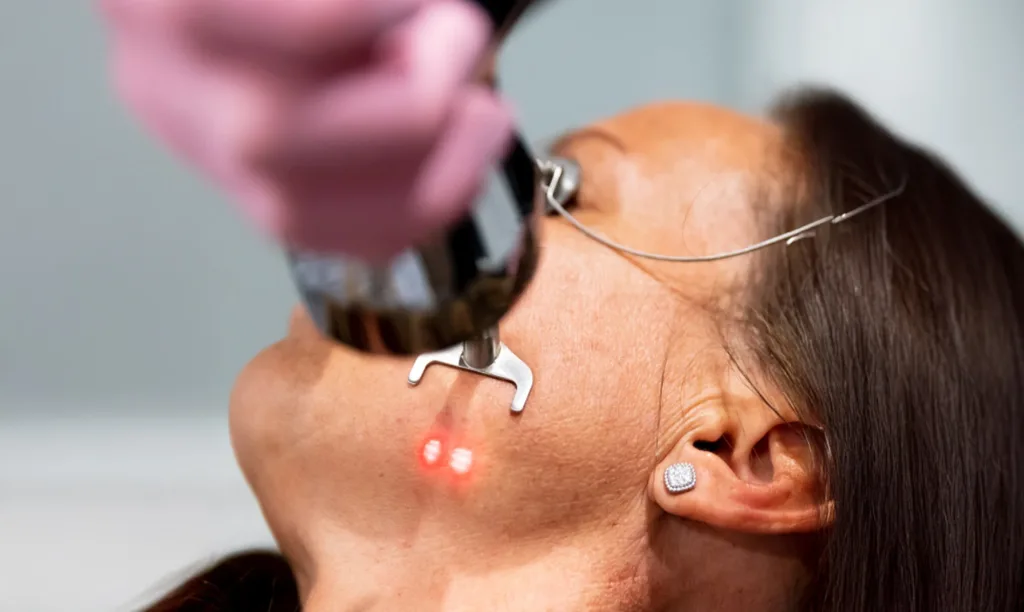 nano laser treatment