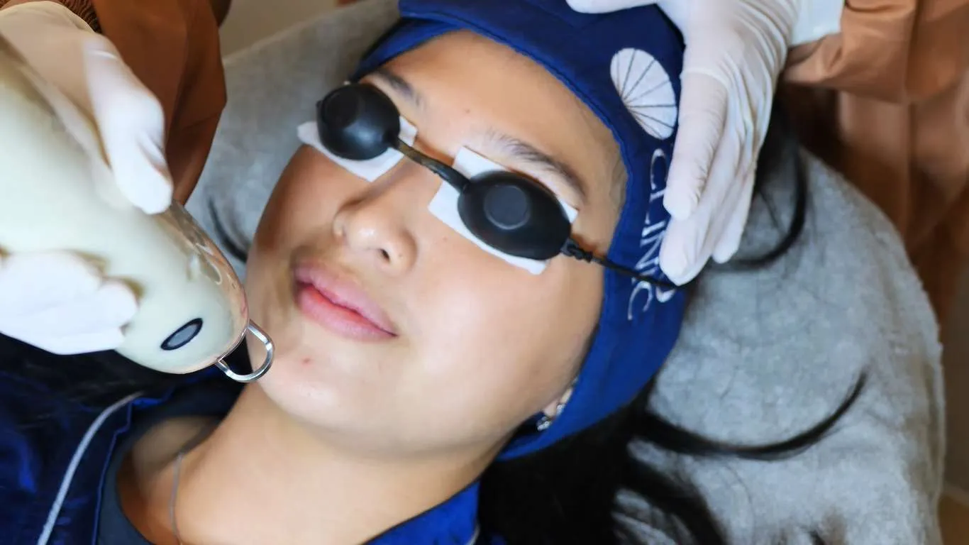 Kulit Kusam dan Kasar? Ini Cara Nano Laser Cerahkan Wajah Tanpa Sakit