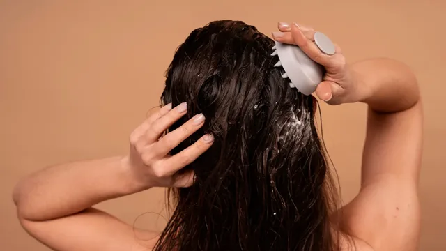 Perawatan Rambut Ketombe: Cara Mengatasi Ketombe dan Menjaga Kulit Kepala Tetap Sehat