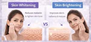 Perbandingan Whitening dan Brightening