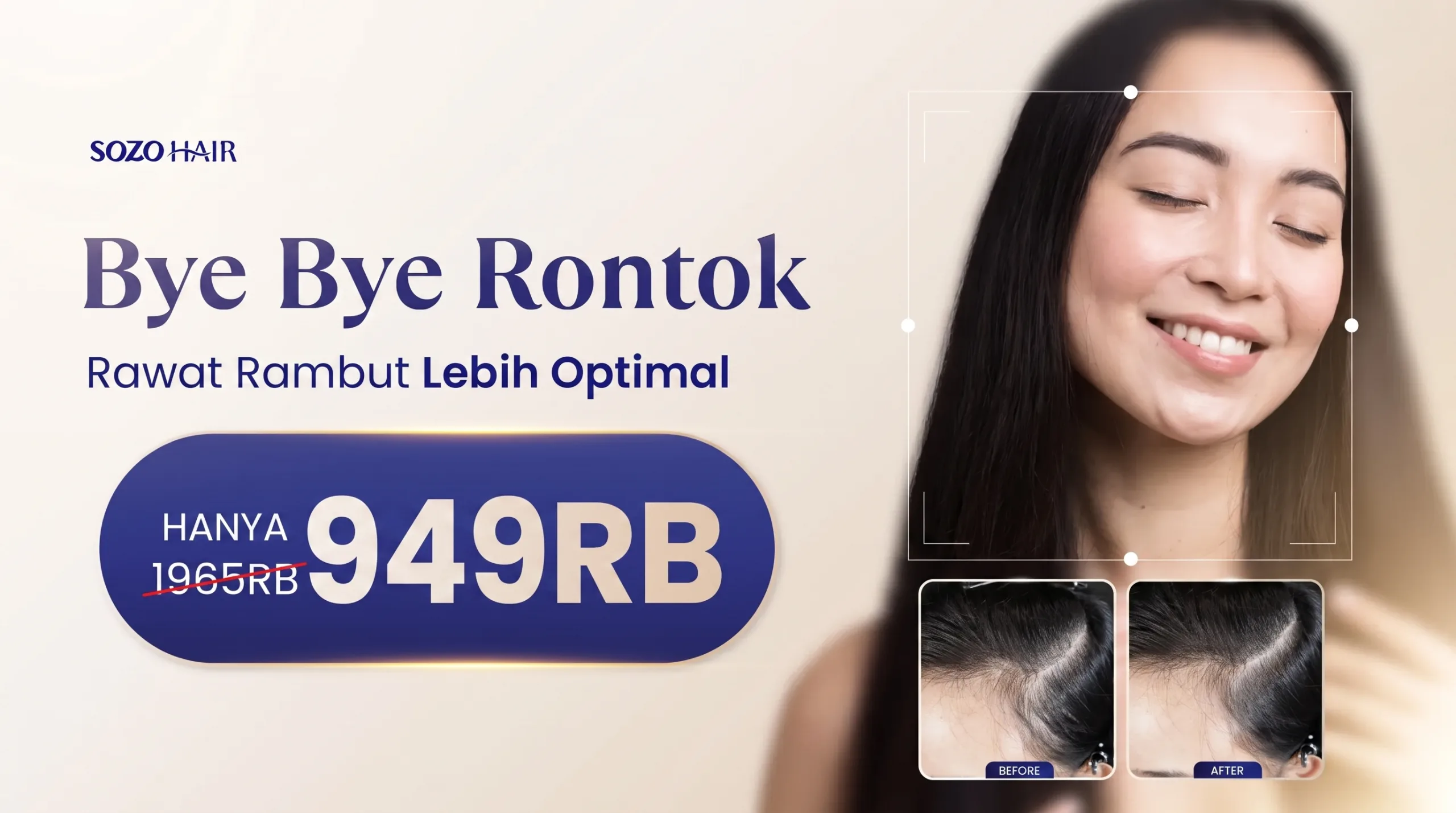 Promo Bye-Bye Rambut Rontok & Botak
