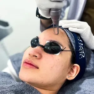 Prosedur Diamond Laser Facial
