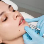 Bukan Cuma Satu Jenis, Ini Panduan Memilih Filler Wajah Sesuai Kebutuhanmu