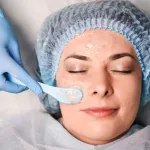 Wajah Kusam Cepat Cerah? Begini Cara Kerja Glow Peel Angkat Sel Kulit Mati