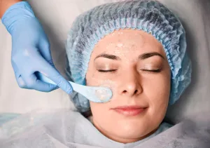 Ilustrasi Tahapan Chemical Peel