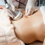 RF Body untuk Mengencangkan Kulit Tubuh yang Mulai Kendur