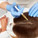 Amankah PRP Rambut? Alasan Terapi Darah Sendiri Minim Efek Samping