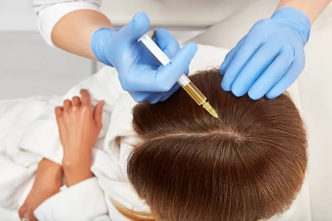Amankah PRP Rambut? Alasan Terapi Darah Sendiri Minim Efek Samping