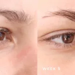Alis Tipis atau Berantakan? Kenali Metode Treatment Alis yang Tersedia