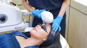 IPL Glow Treatment