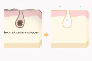 Ilustrasi Cara Kerja BHA