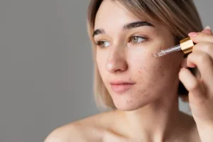 cara mengatasi fungal acne