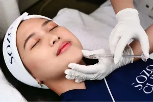 Prosedur Filler Dagu
