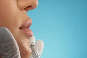 Ilustrasi Prosedur Filler