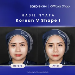 Hasil Korean V Shape