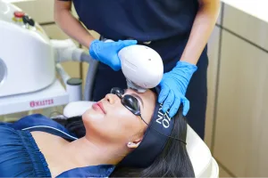 IPL Treatment