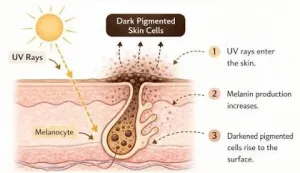 Sinar UV Penyebab Flek Hitam