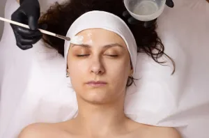 Ilustrasi Prosedur Chemical Peel