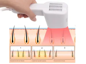 Ilustrasi Cara Kerja IPL Hair Removal