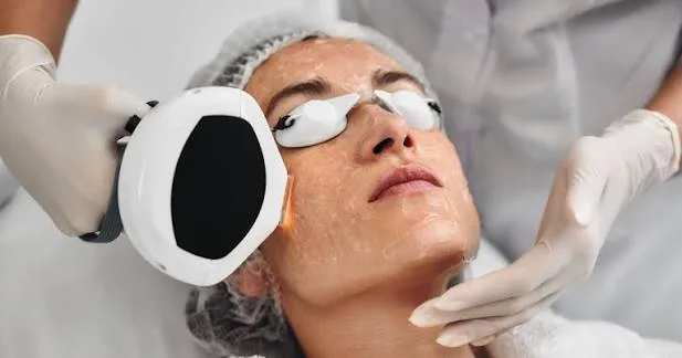 Benarkah IPL Treatment Bisa Menyebabkan Kanker Kulit? Cek Faktanya