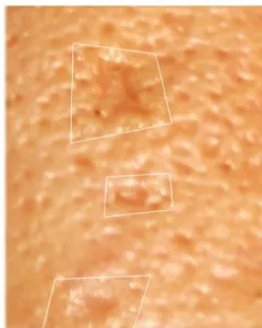 Boxcar Scar