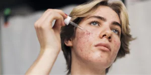 Ilustrasi Penggunaan Skincare