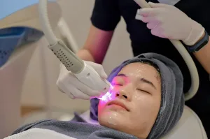laser treatment