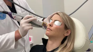 Prosedur Laser vBeam 
