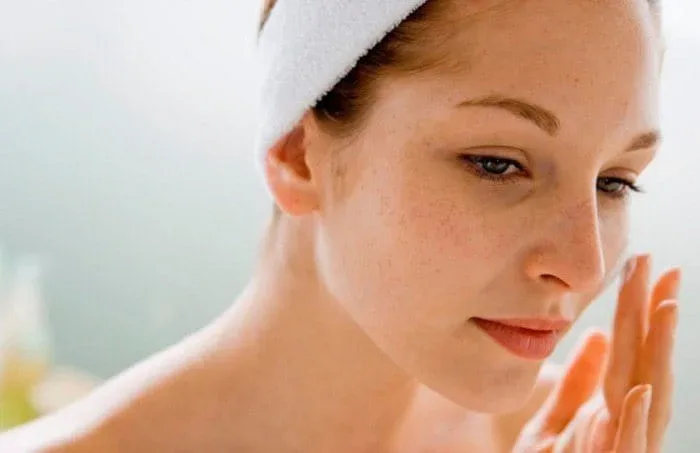 Melasma vs Hiperpigmentasi: Kenali Perbedaannya