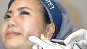 meso treatment
