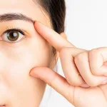 Pelipis Cekung: Peran Filler, Hasil, dan Risikonya