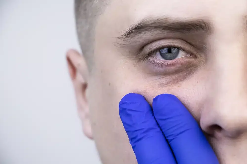 Pemeriksaan Penyebab Mata Panda