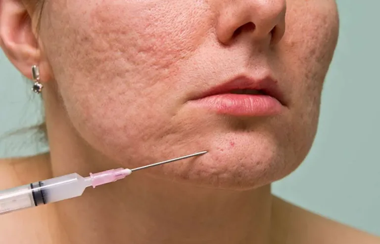 Subsisi vs Skin Booster, Mana yang Kamu Butuhkan?
