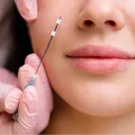 Tarik Benang Hidung: Manfaat, Prosedur, dan Berapa Lama Hasilnya Bertahan?