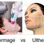 Bingung Pilih Thermage atau Ultherapy? Ini Perbandingannya