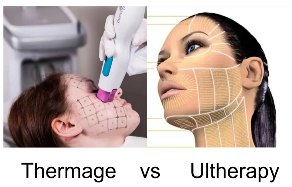 Bingung Pilih Thermage atau Ultherapy? Ini Perbandingannya