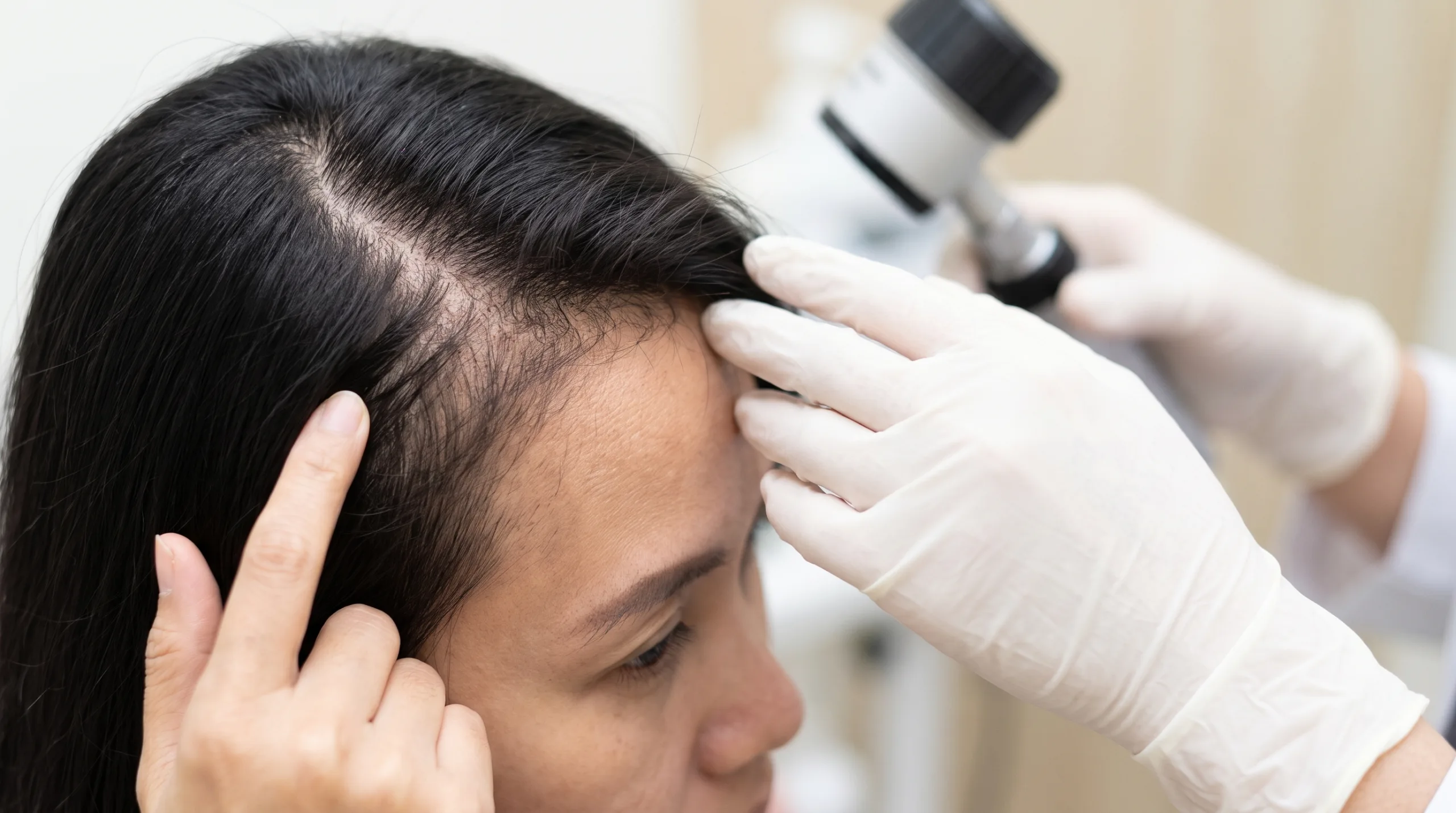 Rambut Wanita Makin Tipis, Apakah PRP Bisa Membantu?