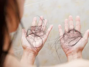 rambut rontok setiap hari