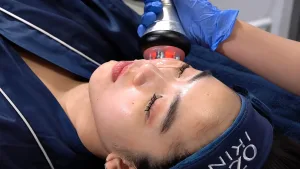 Perawatan RF Wajah