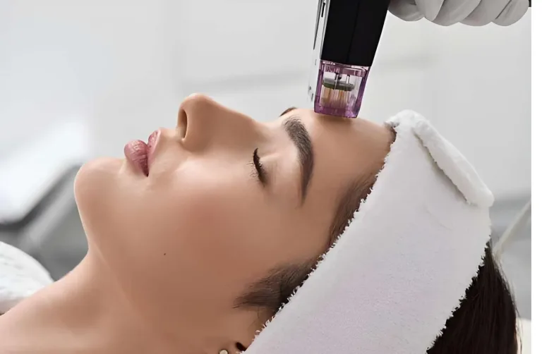 RF Biasa vs RF Microneedling untuk Bopeng: Apa Bedanya?