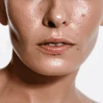 Apa Itu Sebum? Kenapa Kulit Bisa Berminyak dan Mudah Berjerawat?