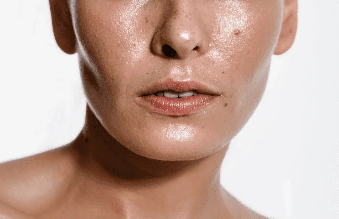 Apa Itu Sebum? Kenapa Kulit Bisa Berminyak dan Mudah Berjerawat?