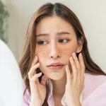 Sun Spot: Kenapa Flek Matahari Sering Muncul di Kulit Kita, dan Cara Memudarkannya