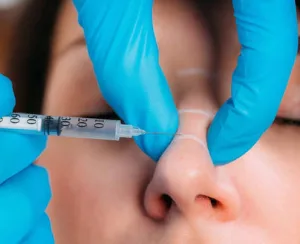 Prosedur Filler Hidung