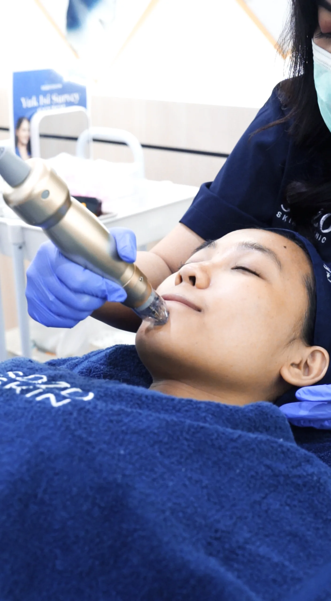 Sylfirm X Microneedle RF di Sozo Skin Clinic