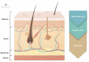Jenis Tingkat Kedalaman Peeling Medis